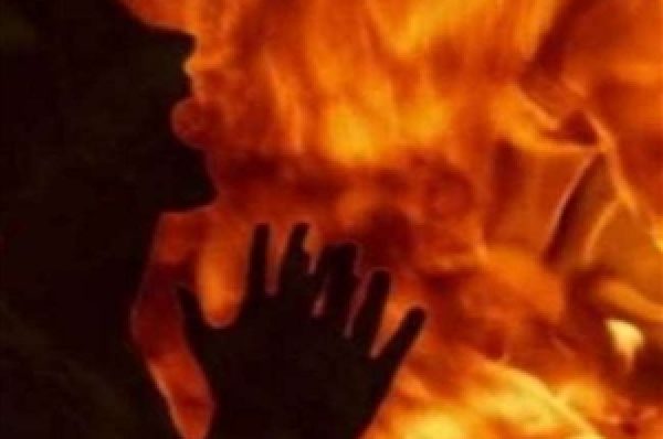 ਬੱਚੇ ਦੇ ਚਿਹਰੇ ‘ਤੇ ਸੈਨੇਟਾਈਜ਼ਰ ਸਪਰੇਅ ਕਰ ਕੇ ਲਾ ਦਿੱਤੀ ਅੱਗ, ਬੁਰੀ ਤਰ੍ਹਾਂ ਝੁਲਸਿਆ