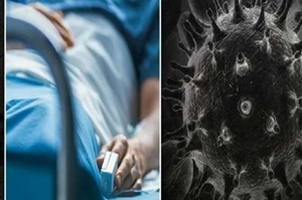 ਦੇਸ਼ ‘ਚ ਕੋਰੋਨਾ ਤੋਂ ਬਾਅਦ ਬਲੈਕ ਫੰਗਸ ਨੇ ਵਧਾਈ ਮੁਸੀਬਤ, ਇਨ੍ਹਾਂ ਦੋ ਸੂਬਿਆਂ ਨੇ ਮਹਾਮਾਰੀ ਐਲਾਨਿਆ ; ਜਾਣੋ ਪੂਰੀ ਅਪਡੇਟ