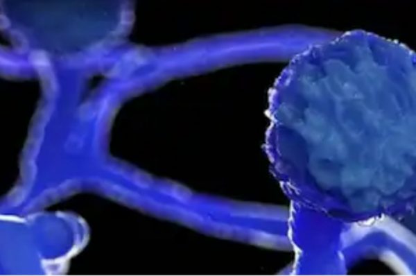 ਬਠਿੰਡਾ ਵਿਚ ਬਲੈਕ ਫੰਗਸ ਦੀ ਦਸਤਕ, 4 ਮਰੀਜ਼ ਆਏ ਸਾਹਮਣੇ