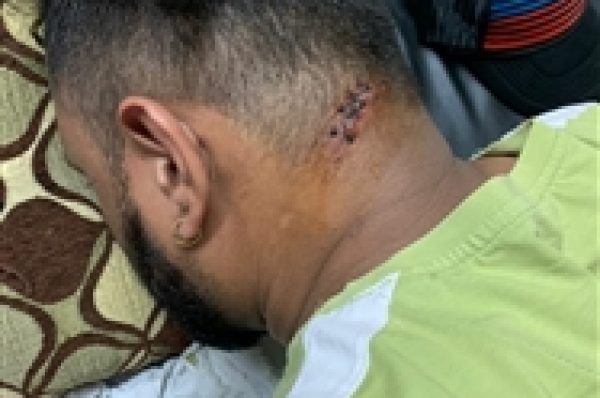 ਅਫਸੋਸ ਕਰਨ ਆਏ ਬਿਲਡਰ ਨੇ ਪਰਿਵਾਰ ‘ਤੇ ਕਾਤਲਾਨਾ ਹਮਲਾ ਕਰ ਕੇ ਹੋਇਆ ਫਰਾਰ, ਪੁਲਿਸ ਖੰਗਾਲ ਰਹੀ CCTV ਫੁਟੇਜ਼