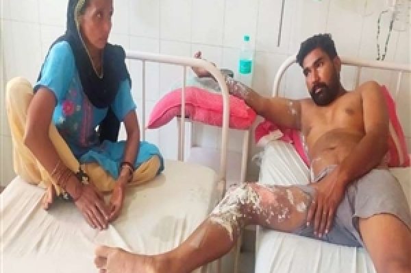 ਜ਼ਮੀਨ ਵਾਪਸ ਨਾ ਮੋੜੀ ਤਾਂ ਦਾਦੇ ਨੇ ਪੋਤਰੇ ਤੇ ਪੋਤਨੂੰਹ ‘ਤੇ ਸੁੱਟਿਆ ਪੈਟਰੋਲ, ਬੱਚੀ ‘ਤੇ ਵੀ ਨਹੀਂ ਆਇਆ ਰਹਿਮ