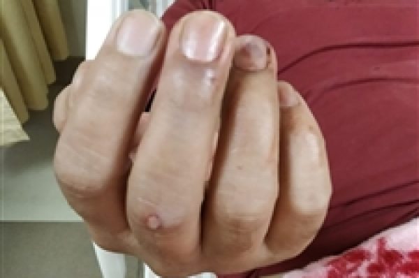 ਸਿਰ ਵਿੱਚ ਬਾਲੇ ਮਾਰ ਕੇ ਅਧੇੜ ਵਿਅਕਤੀ ਨੂੰ ਕੀਤਾ ਅੱਧ ਮਰਿਆ, ਕਾਰ ਉੱਪਰ ਕੰਧ ਡਿੱਗਣ ਨੂੰ ਲੈ ਕੇ ਹੋਇਆ ਸੀ ਝਗੜਾ