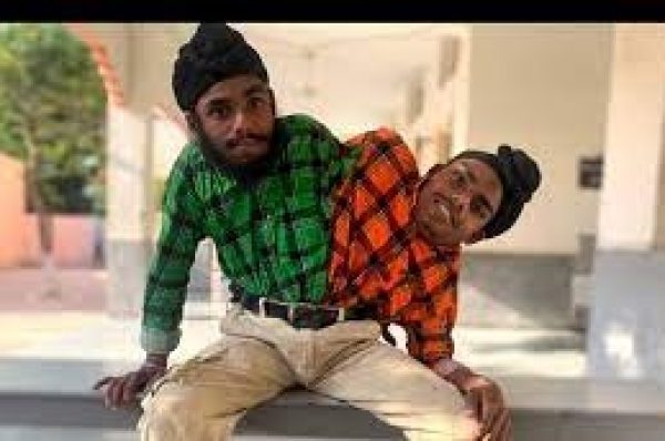 ਸਰੀਰਕ ਪੱਖੋਂ ਜੁੜੇ ਭਰਾਵਾਂ ਨੂੰ ਨਹੀਂ ਮਿਲ ਰਿਹਾ ਅਪਾਹਜ ਹੋਣ ਦਾ ਸਰਟੀਫਿਕੇਟ